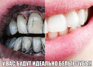 Как сохранить зубы белыми надолго