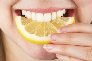 Методы отбеливания зубов разными способами