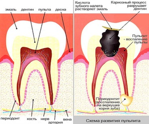 Описание пульпы зубов