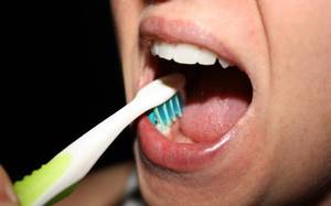 Правила подготовки к удалению нерва зуба в домашних условиях