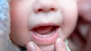 Порядок появления зубов у малыша