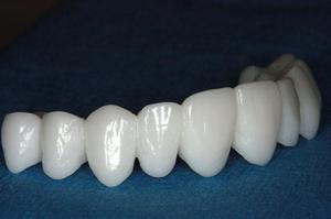 Показания для установки зубных протезов