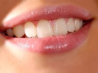 Особенности правильного отбеливания зубов