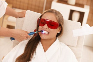 Описание способов отбеливания зубной эмали