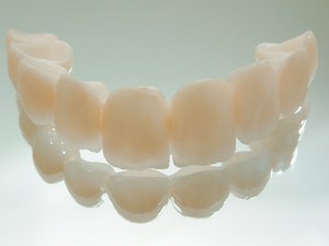 Как можно установить коронки на передние зубы