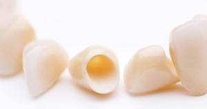 Пластмассовые коронки на зубы