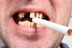 Плохие привычки и зубы
