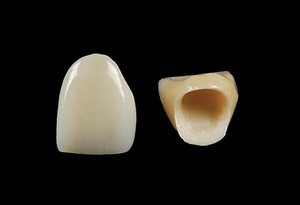 Описание особенностей коронок для зубов