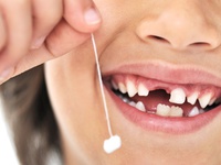 Смена молочных зубов на коренные