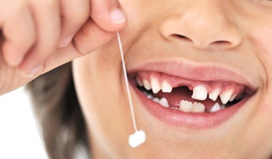 Смена молочных зубов на коренные