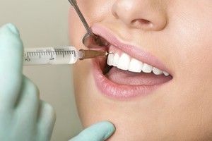 Описание анестетиков для лечения зубов при беременности
